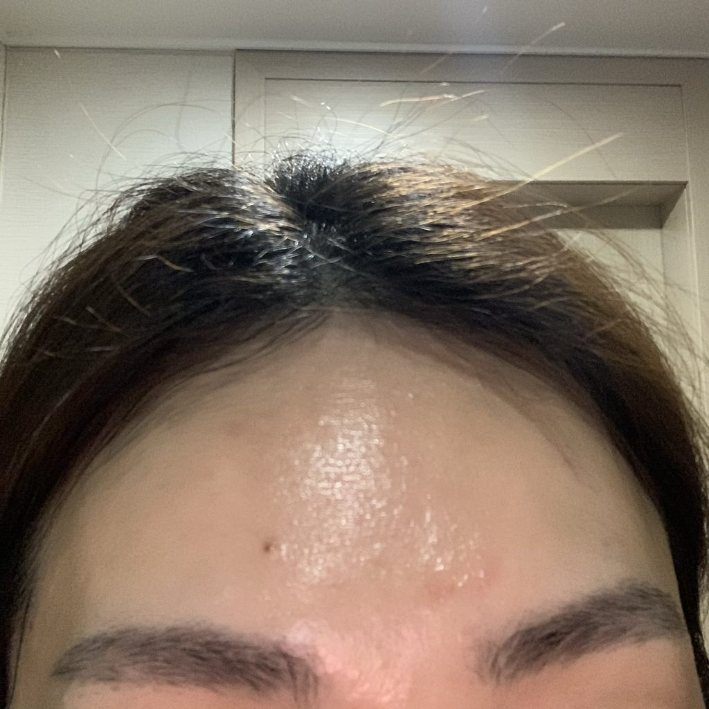 因赫瑟保湿精华的真实用户使用照片