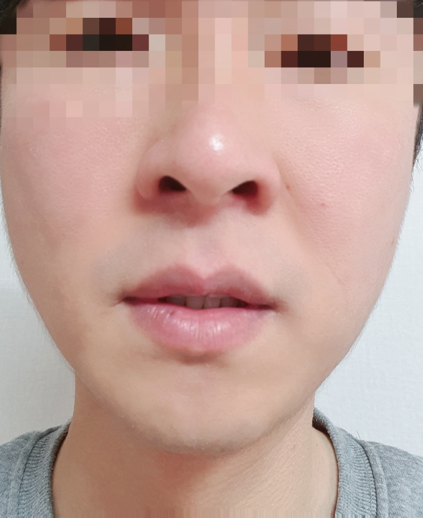 初始99屏障终极霜的真实用户使用照片