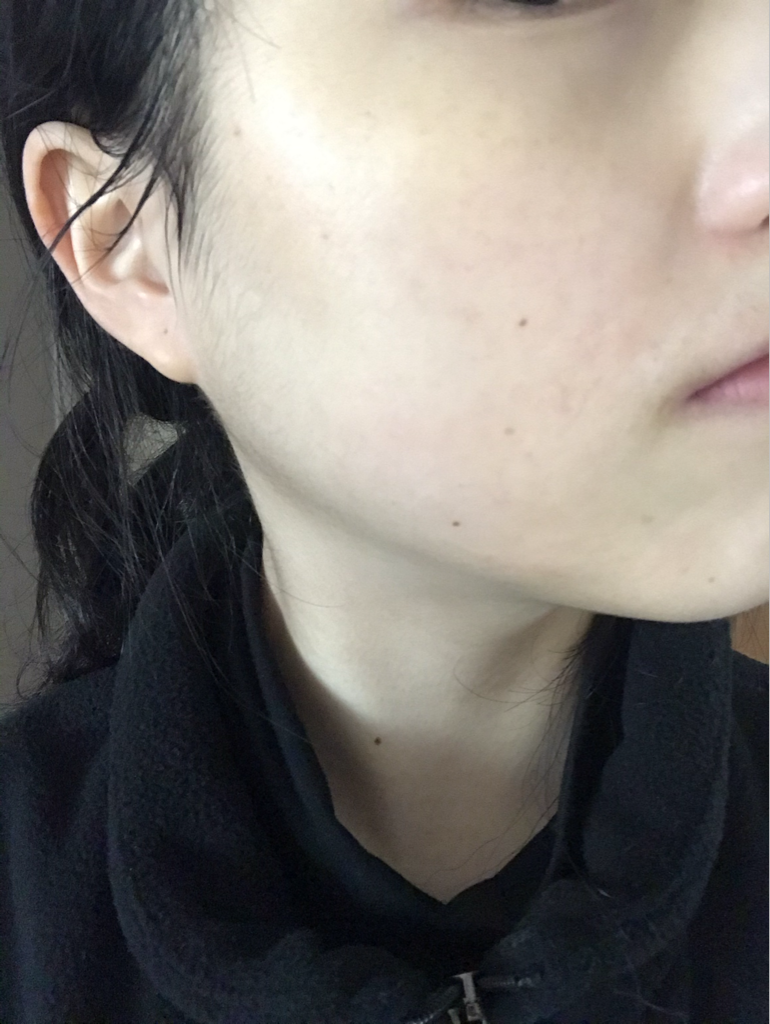 初始99屏障终极霜的真实用户使用照片