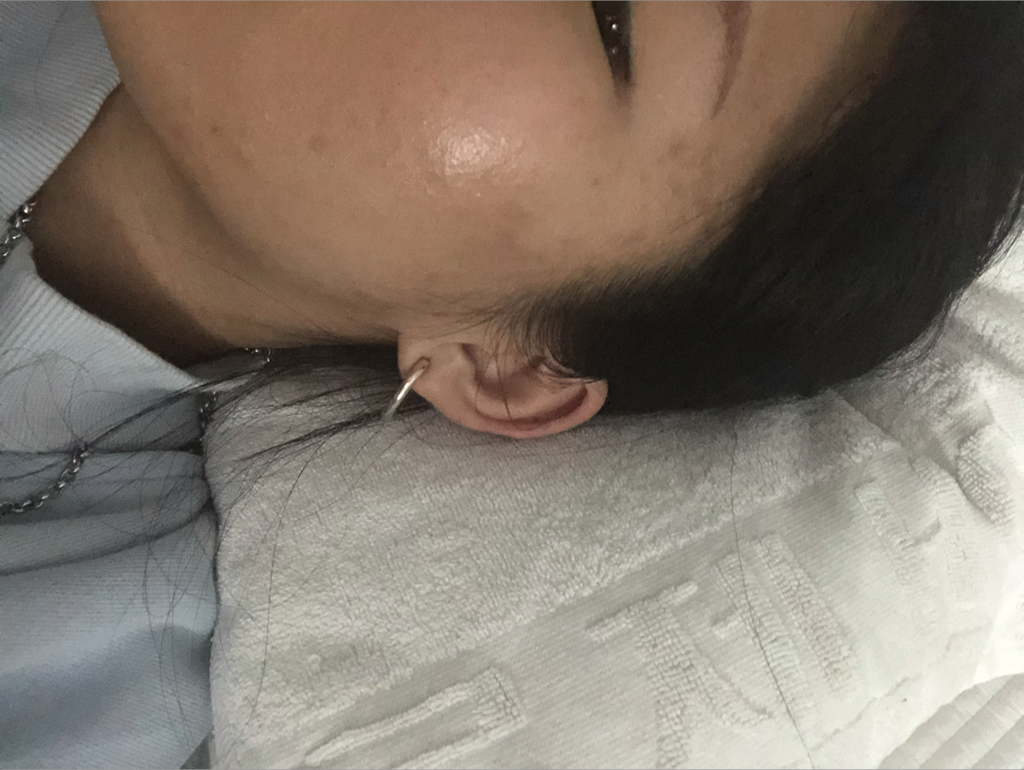 Flucion 17 crème的真实用户使用照片