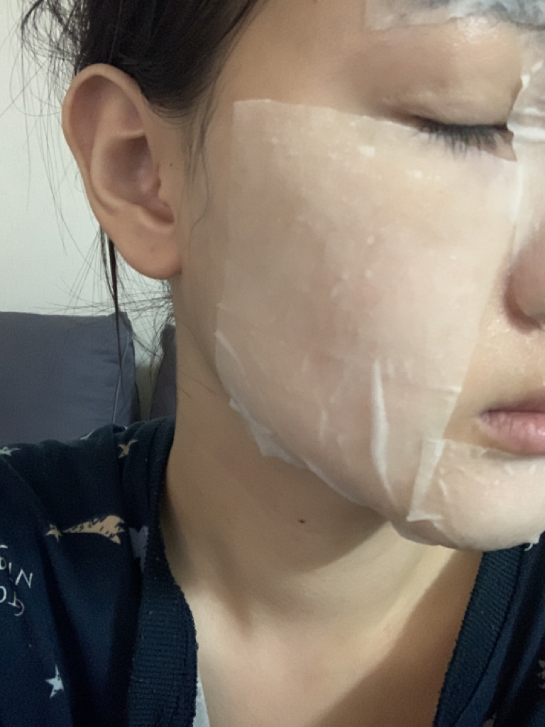 乳糖酵母安瓿97%的真实用户使用照片