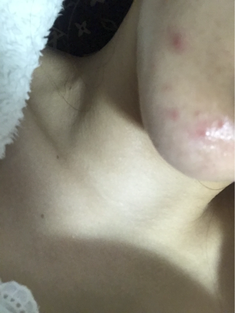 神奇阿托超保湿霜的真实用户使用照片