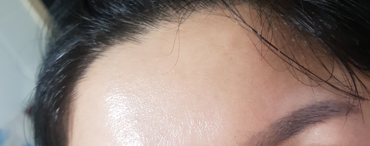 修复密集精华的真实用户使用照片