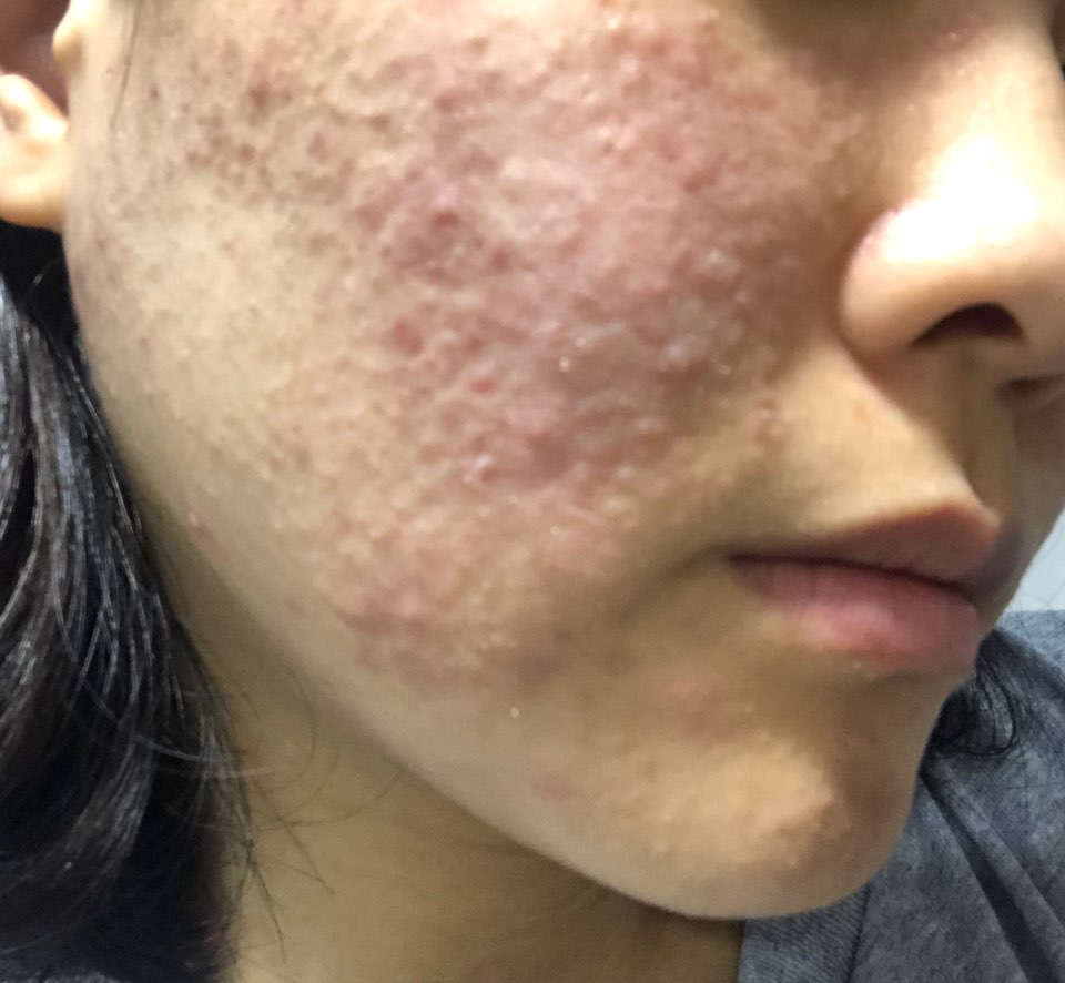 ATALPHA Alloferon Peptide Repair Cream review image