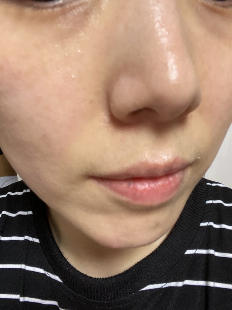Real user review photo of Lightweight Facial Hydrating Serum