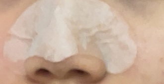 Real user review photo of volcanic nose pack
