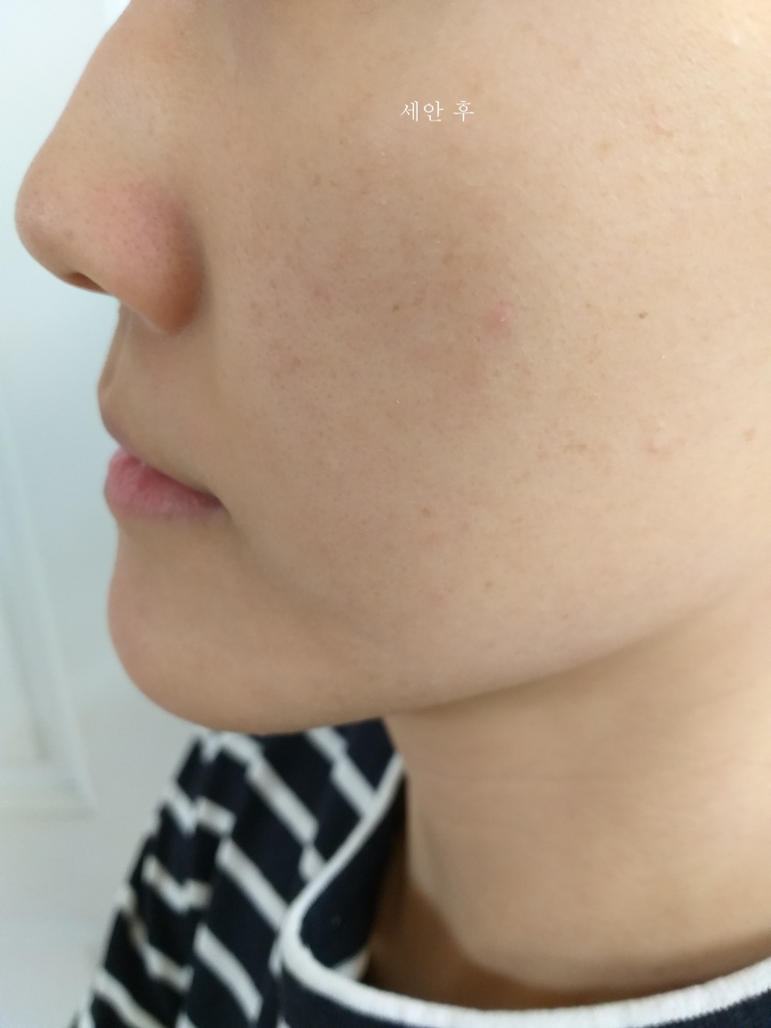 비바스 (VIBAS) 인텐시브 퓨어비타민C 앰플 review image