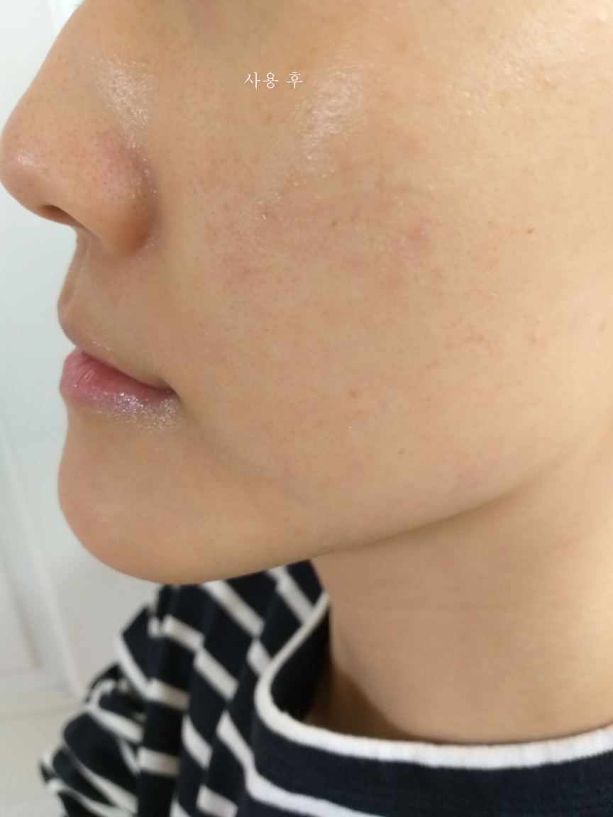 비바스 (VIBAS) 인텐시브 퓨어비타민C 앰플 review image