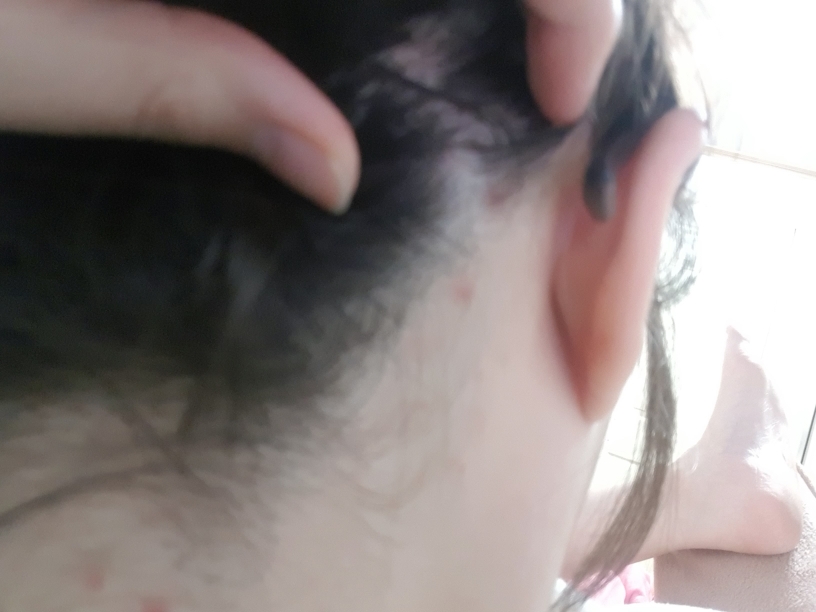 enesti 混合浆果炸弹护理 common.review image