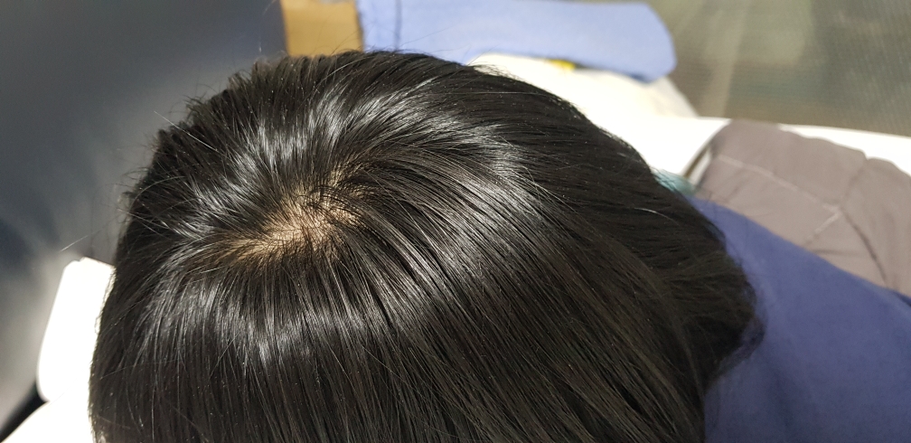 두피부 (DOOPEEBOO) 스칼프 모이스처라이징 드라이 앰플 review image