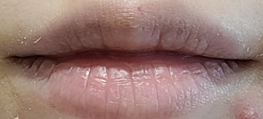 아이소이 LIP TREATMENT BALM [Pure Red] review image