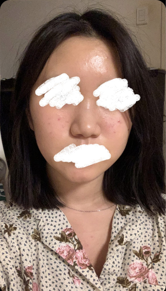 SOS 集中护理的真实用户使用照片