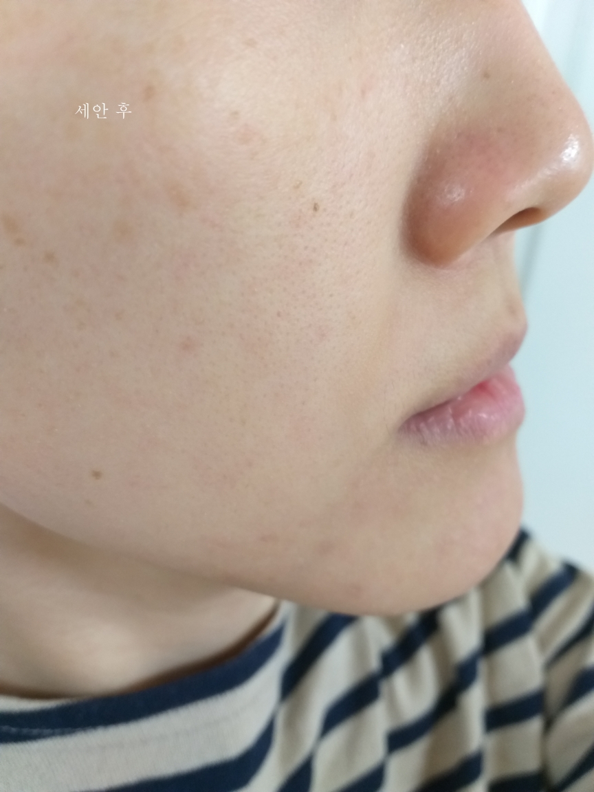 론지 (Lon.G) 리페어 스킨백 캡슐 크림 review image