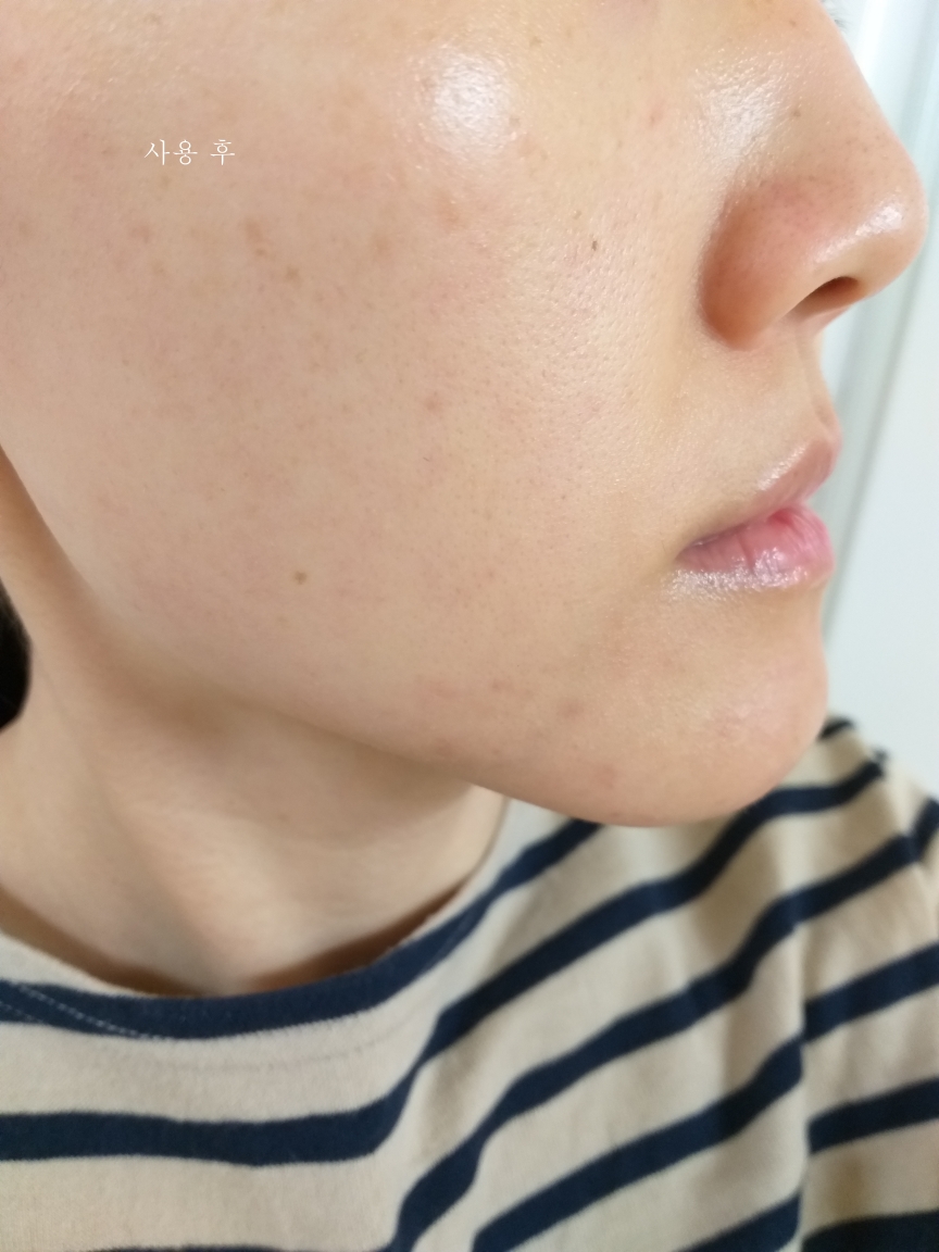 론지 (Lon.G) 리페어 스킨백 캡슐 크림 review image