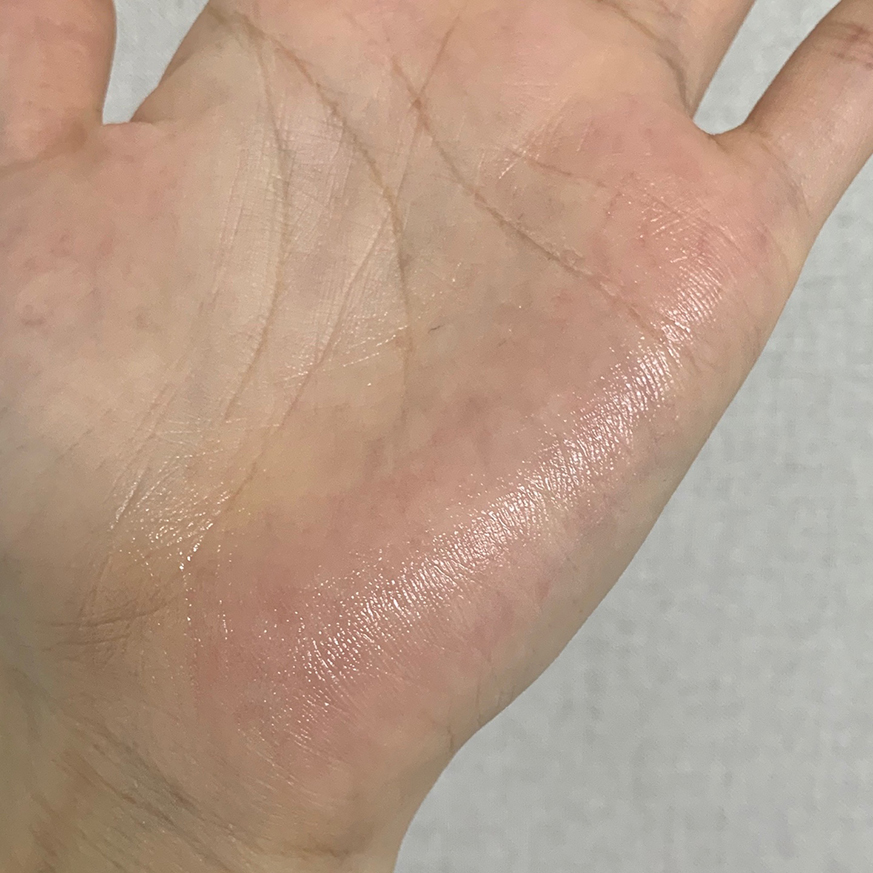 락토덤 (LACTO-DERM) 프로폴렌 링클 솔루션 크림 review image