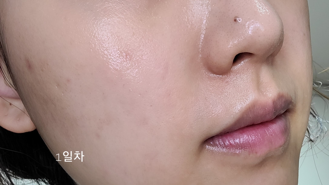 이퀄리브 (equlib) 오 브리에 패드 review image