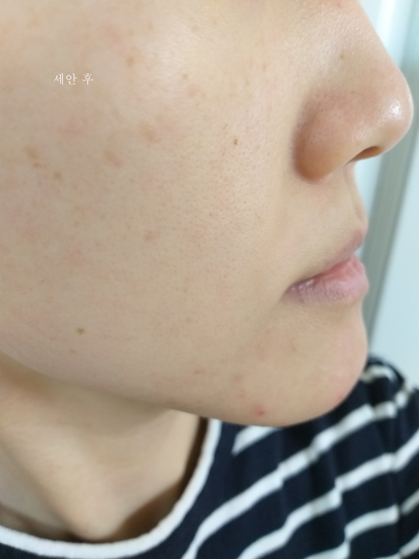 토피크렘 (TOPICREM) DA 에몰리언트 밤 review image