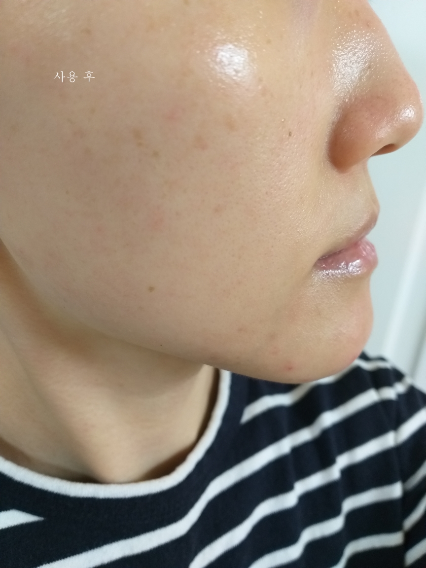 토피크렘 (TOPICREM) DA 에몰리언트 밤 review image