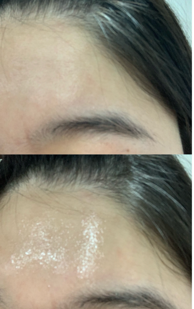 100% 天然有机玫瑰果油的真实用户使用照片