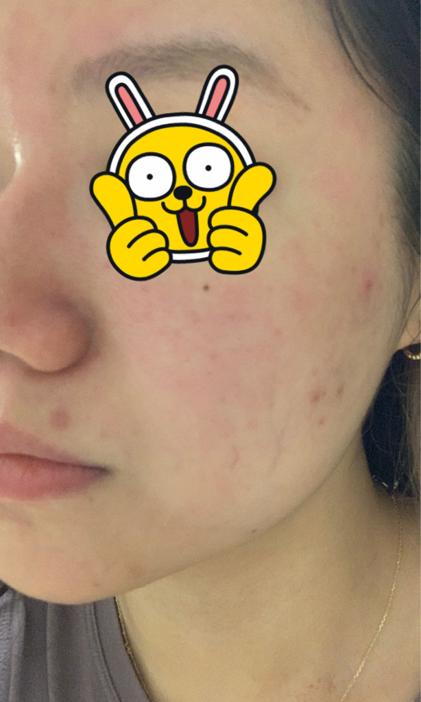 좀비뷰티 (ZOMBIEBEAUTY) 블러디 필 review image