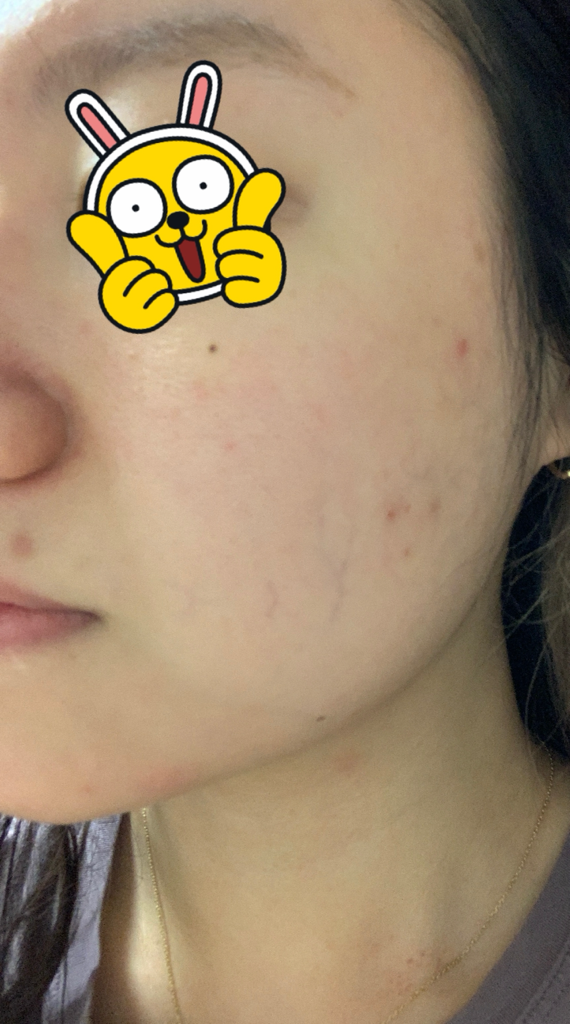 좀비뷰티 (ZOMBIEBEAUTY) 블러디 필 review image
