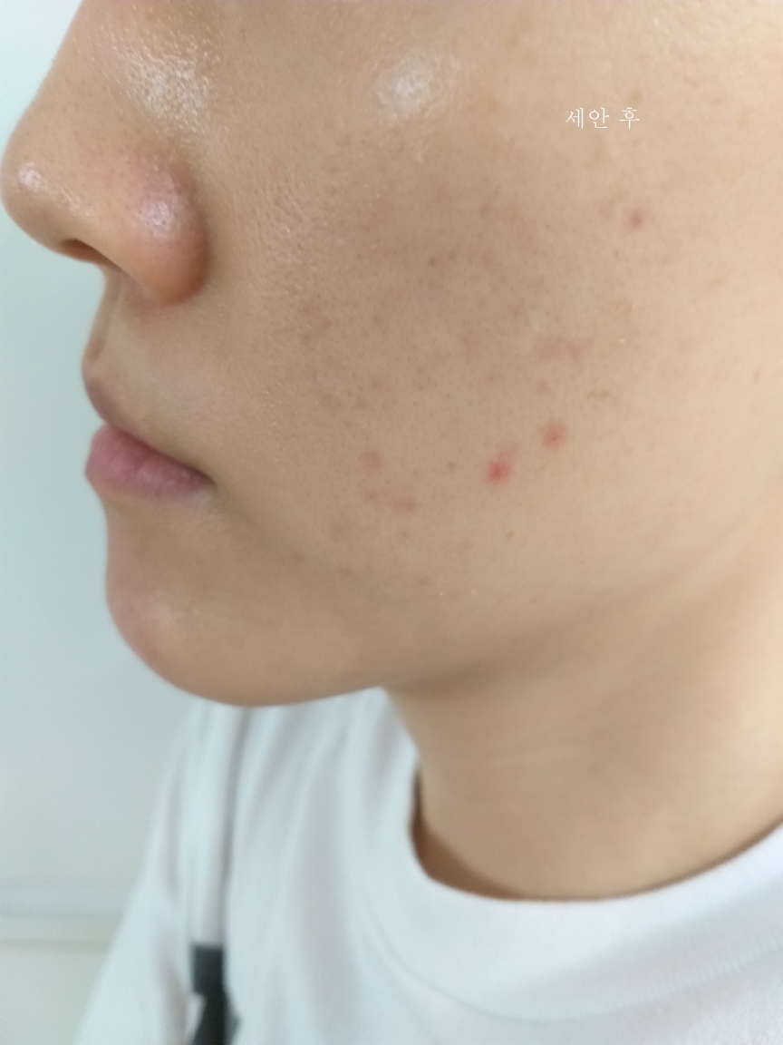 세바메드 (sebamed) 올리브 페이스 앤 바디워시 review image