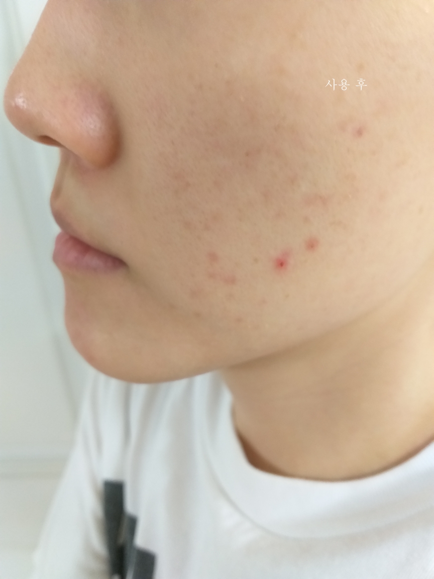 세바메드 (sebamed) 올리브 페이스 앤 바디워시 review image