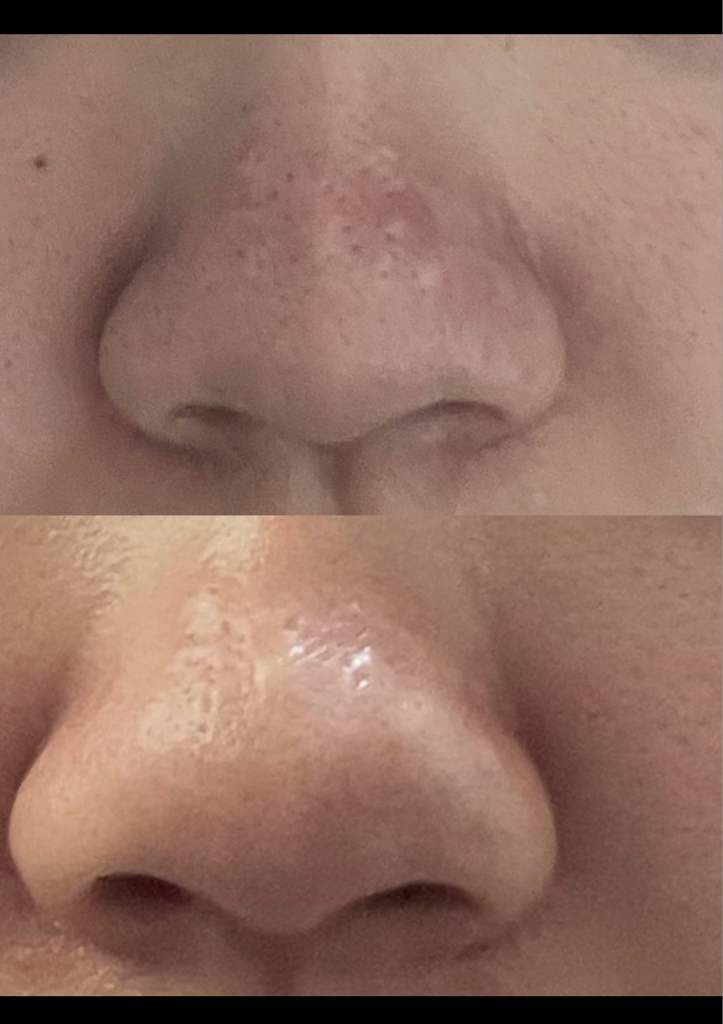 胶原蛋白面膜的真实用户使用照片