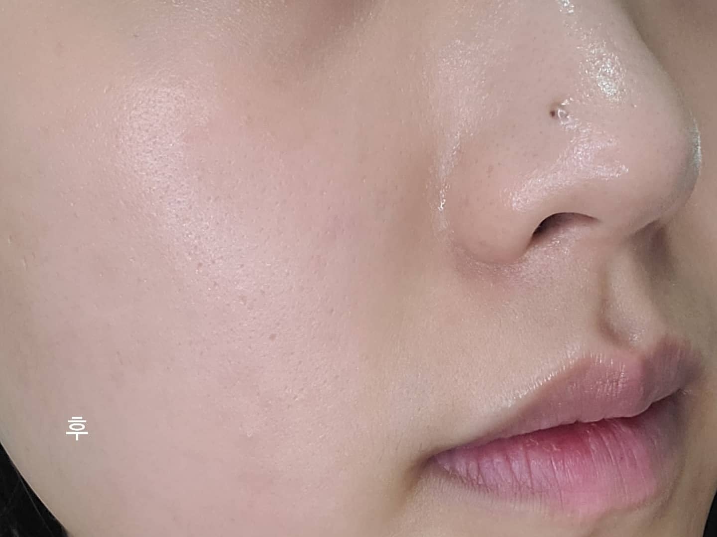퍼미덤 (permeaderm) 이지에프 시그니처 앰플 review image