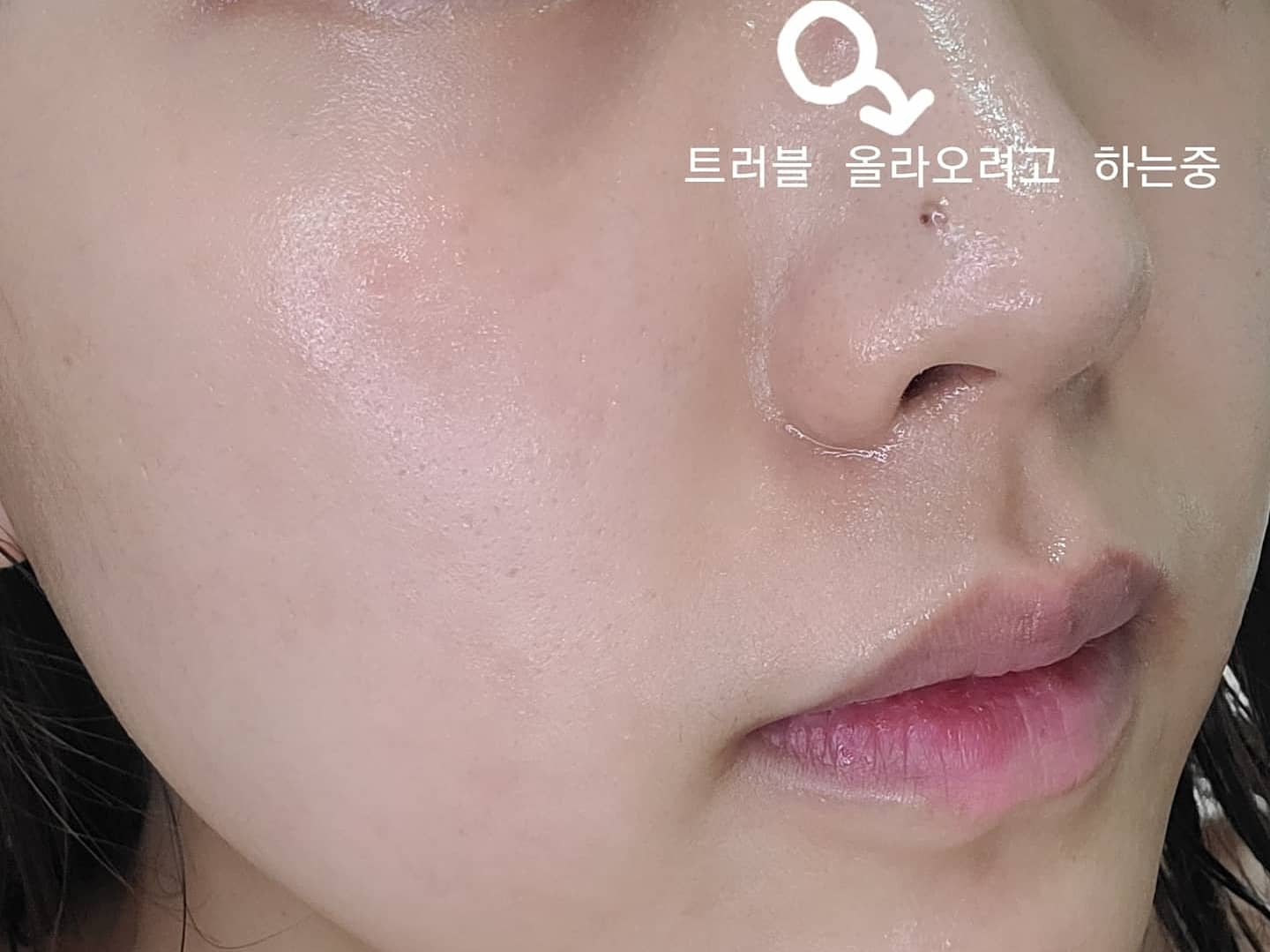 퍼미덤 (permeaderm) 이지에프 시그니처 앰플 review image
