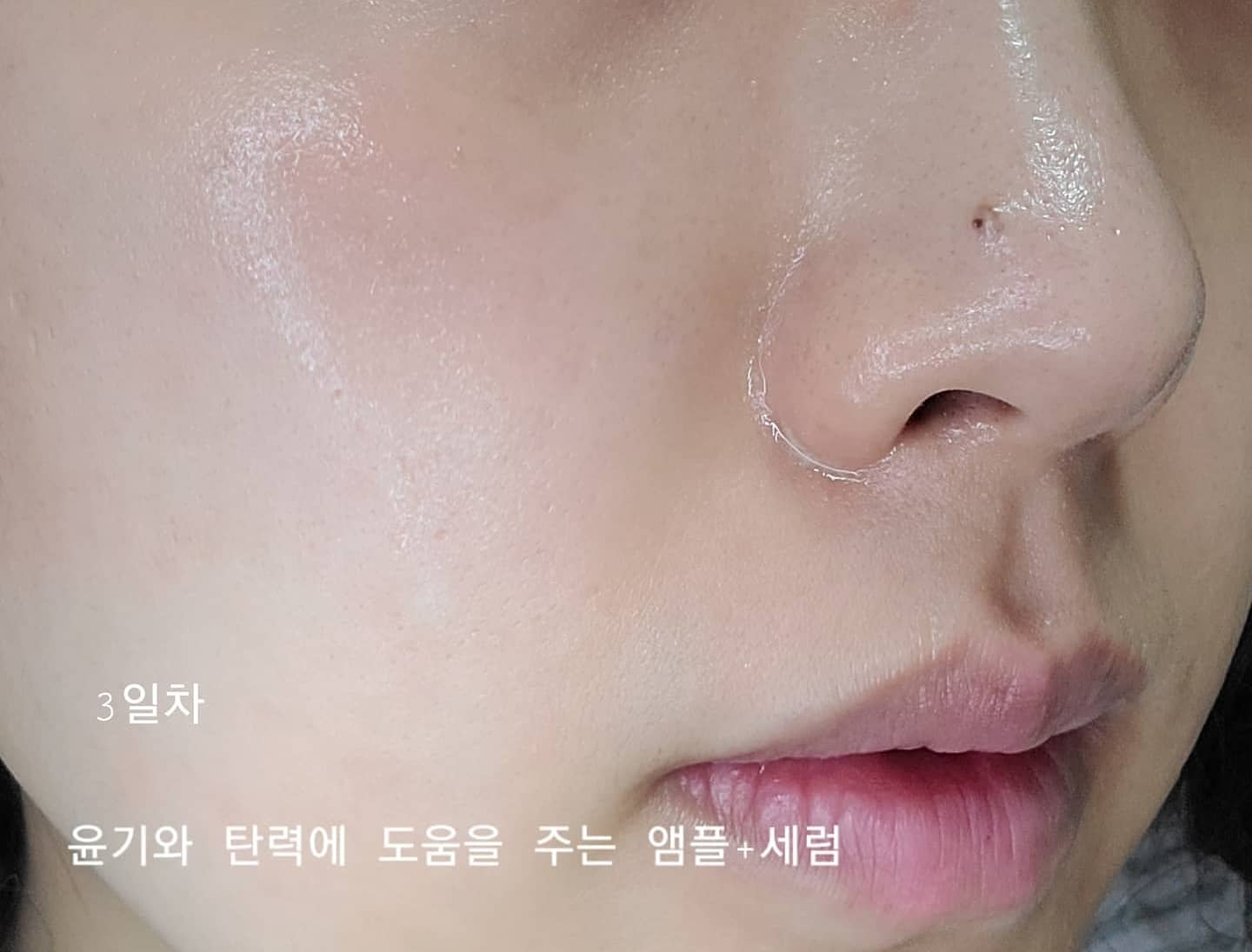 퍼미덤 (permeaderm) 이지에프 시그니처 앰플 review image