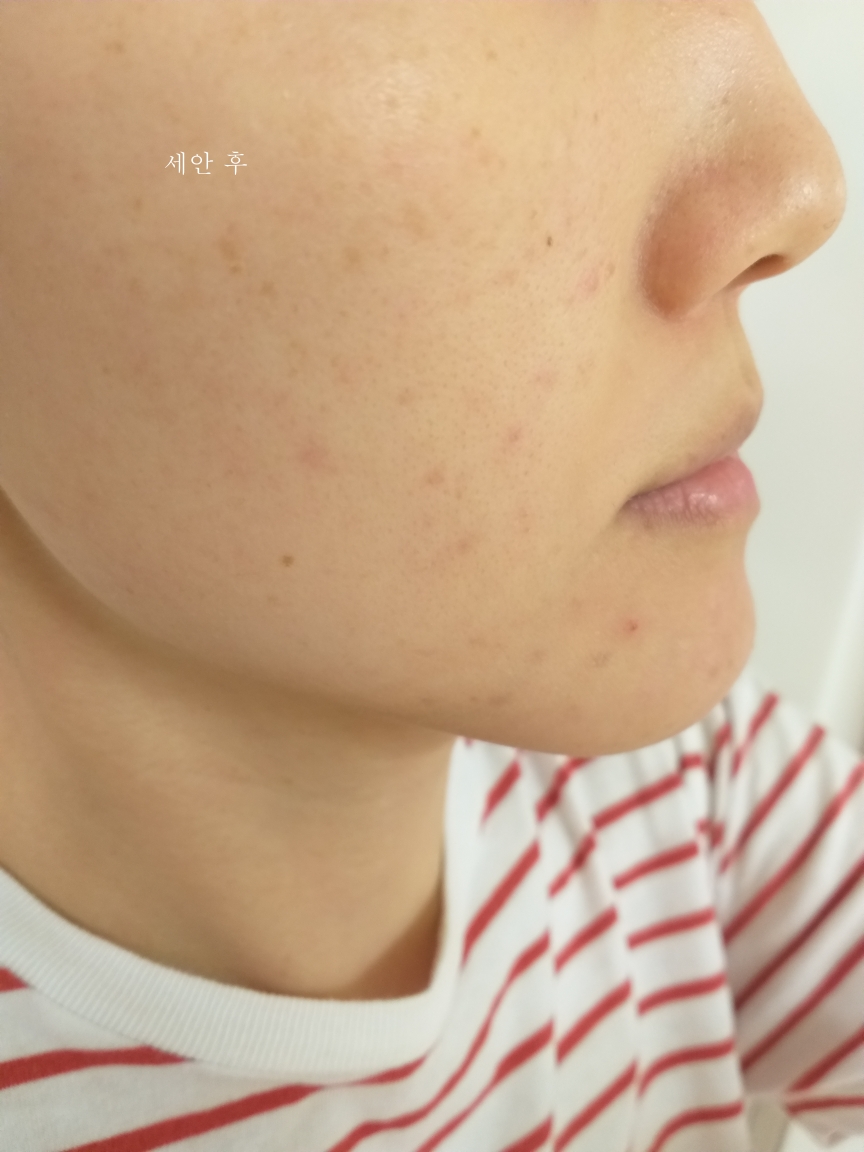 뉴라덤 (NEURADERM) 엠비티 하이드레이션 핏 마스크 review image