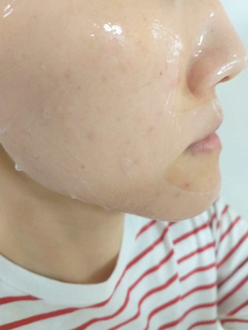 뉴라덤 (NEURADERM) 엠비티 하이드레이션 핏 마스크 review image