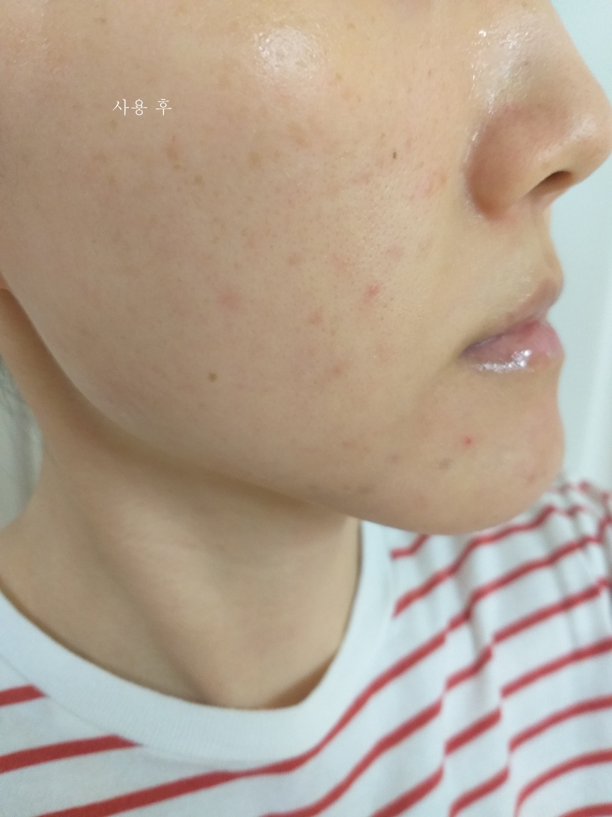 뉴라덤 (NEURADERM) 엠비티 하이드레이션 핏 마스크 review image
