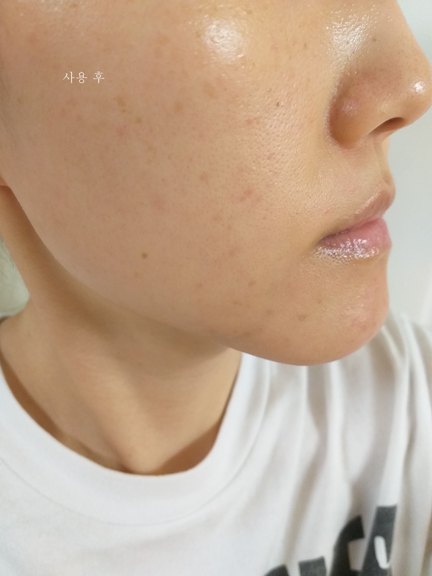 에이르 (EIR) 캡슐 세럼 review image