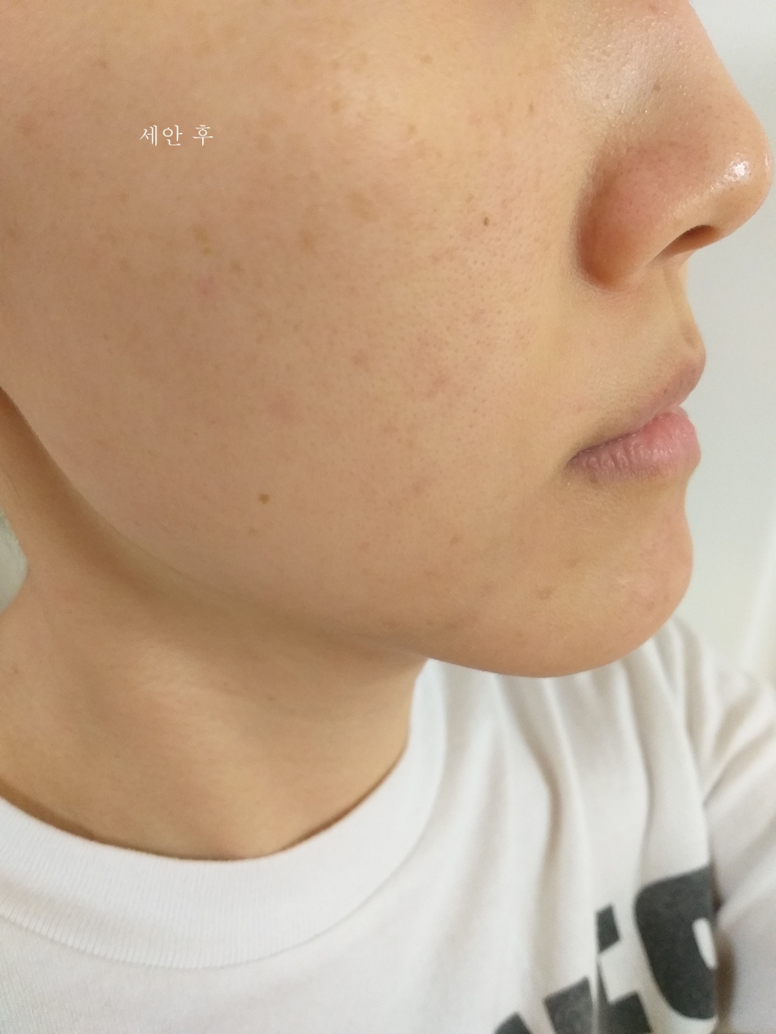에이르 (EIR) 모이스처 크림 review image