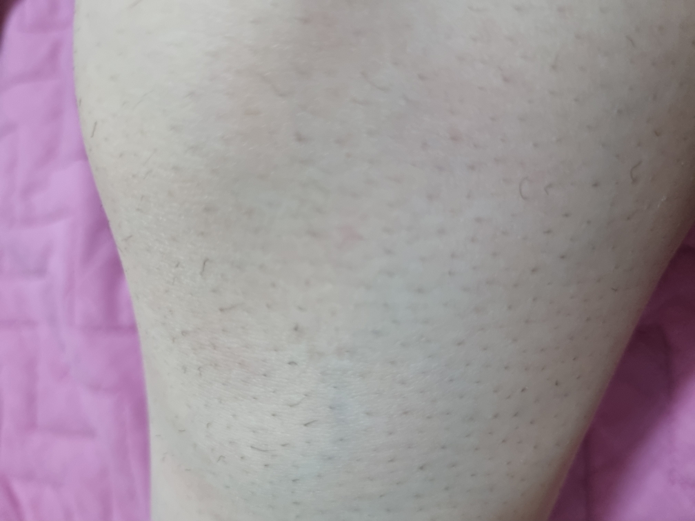 BEAUTYFORMULAS Shea Butter Hair Removal Cream review image