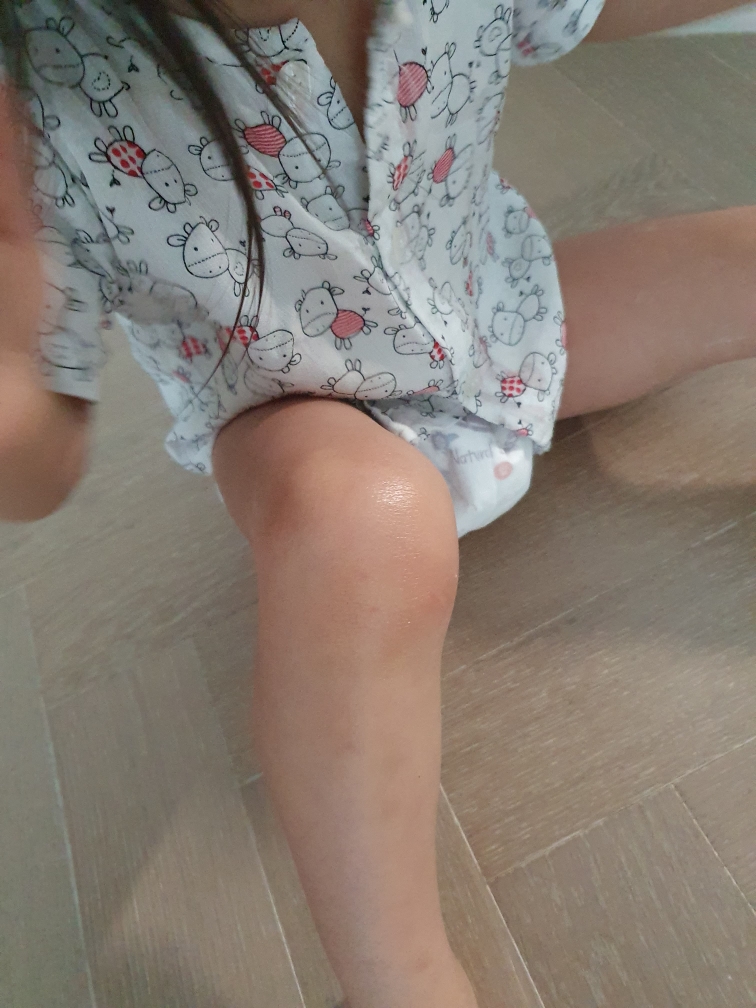 베비언스 (Babience) 아토케어 데일리 로션 review image
