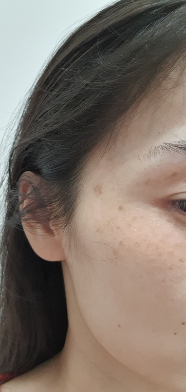 보타닉센스 (Botanicsens) 카르본 멜라닌에센스 review image