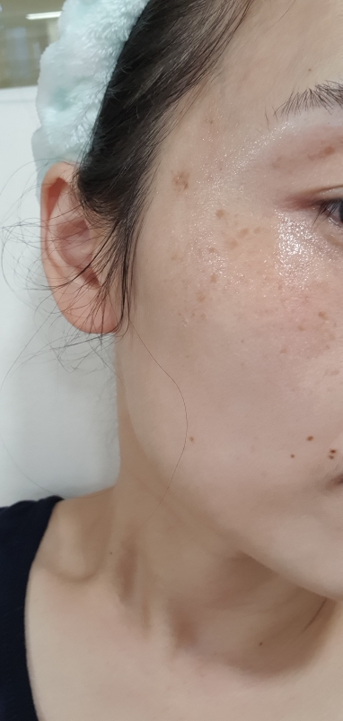 보타닉센스 (Botanicsens) 카르본 멜라닌에센스 review image