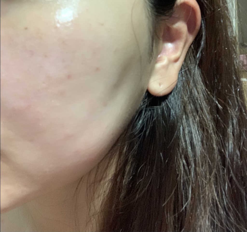 碳黑色素霜的真实用户使用照片