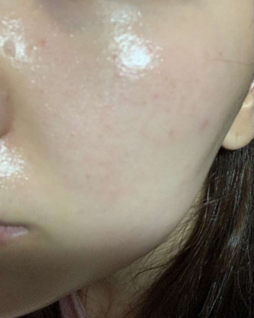 碳黑色素霜的真实用户使用照片