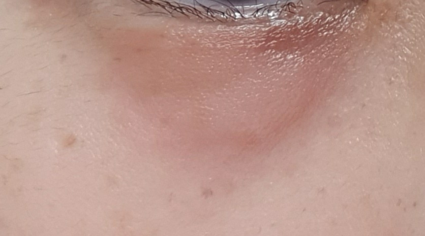 新瑞典蛋包酸奶和 Edelweiss的真实用户使用照片