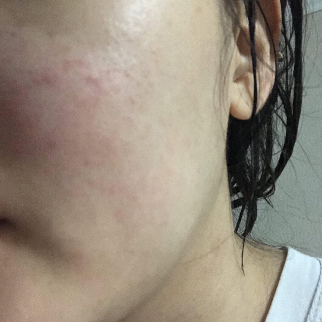 NOMALNOMORE 抗干燥强化爽肤水 common.review image