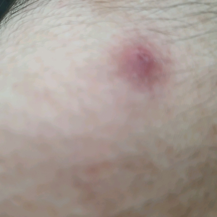 AC 纯净芦荟修复霜的真实用户使用照片