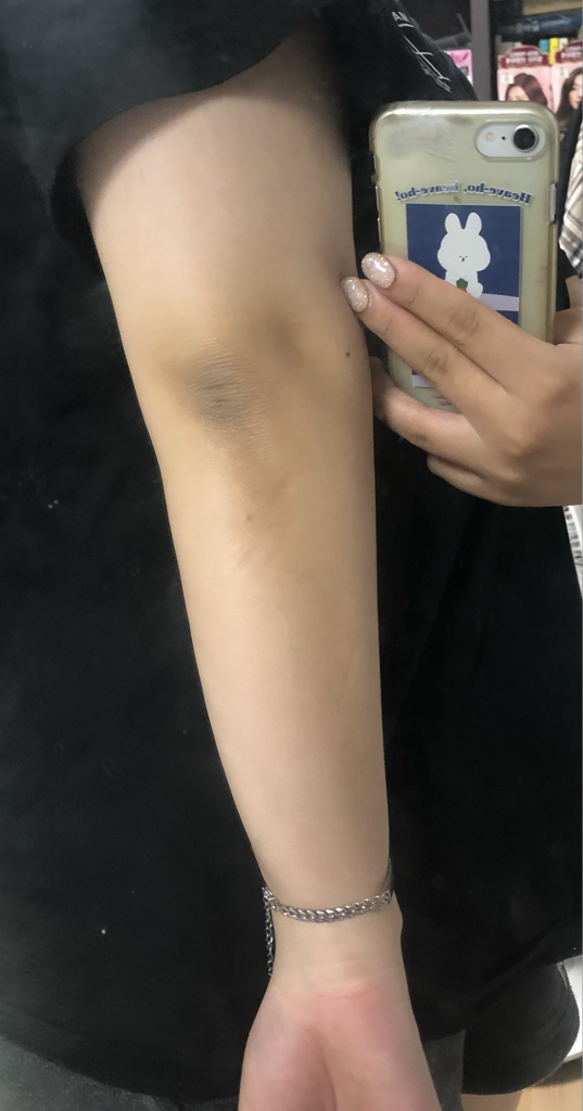 뷰티영 (Beautyoung) 블랙아웃 미백크림 review image