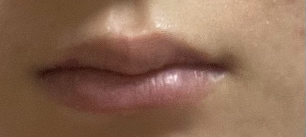 Real user review photo of lip treatment