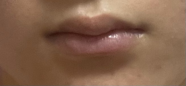 Real user review photo of lip treatment