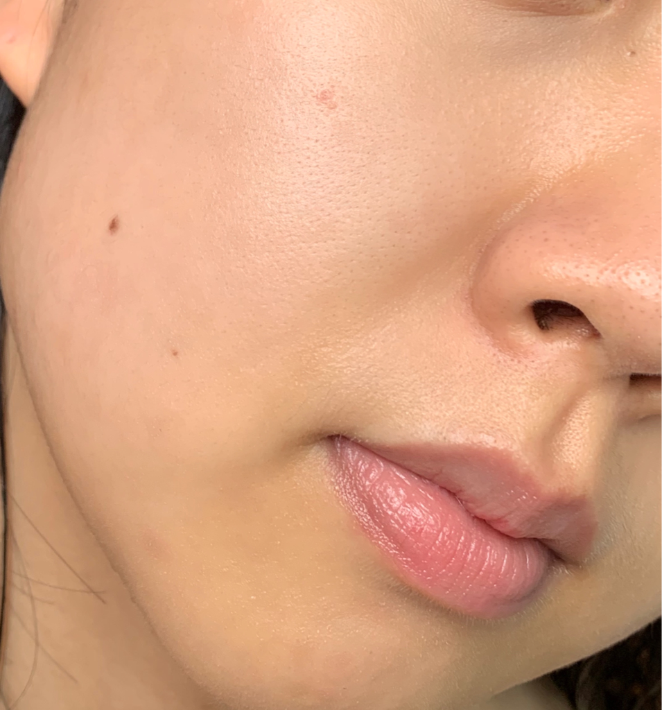 브리스킨 (briskin) 리얼핏 세컨드스킨 바이오셀룰로오스 마스크 [SOS트러블케어] review image