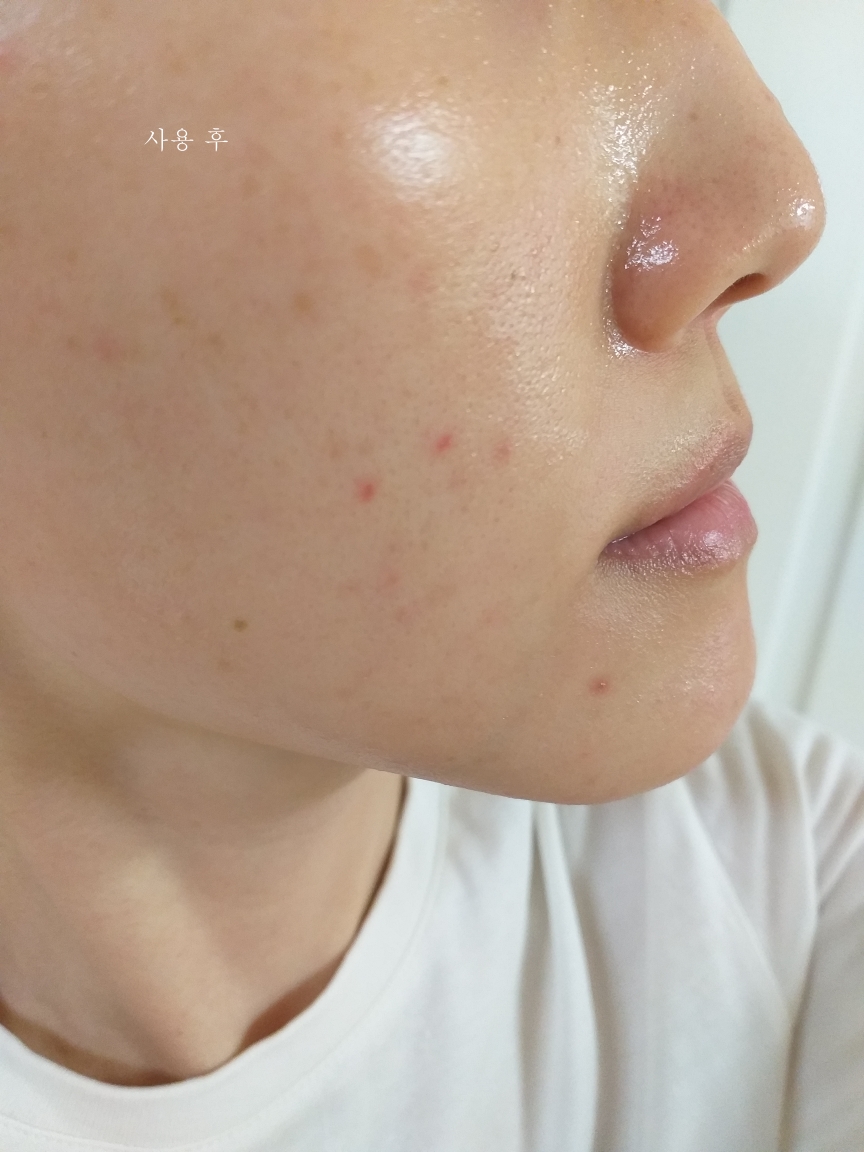 舒缓保湿凝胶的真实用户使用照片